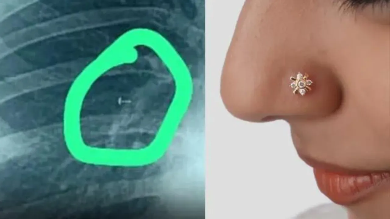 Woman Inhales Nose Pin Screw