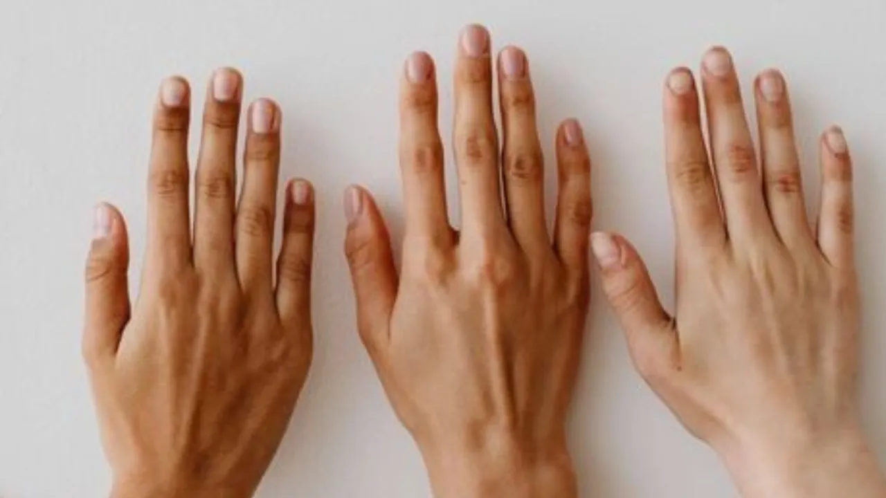 Fair skin observation