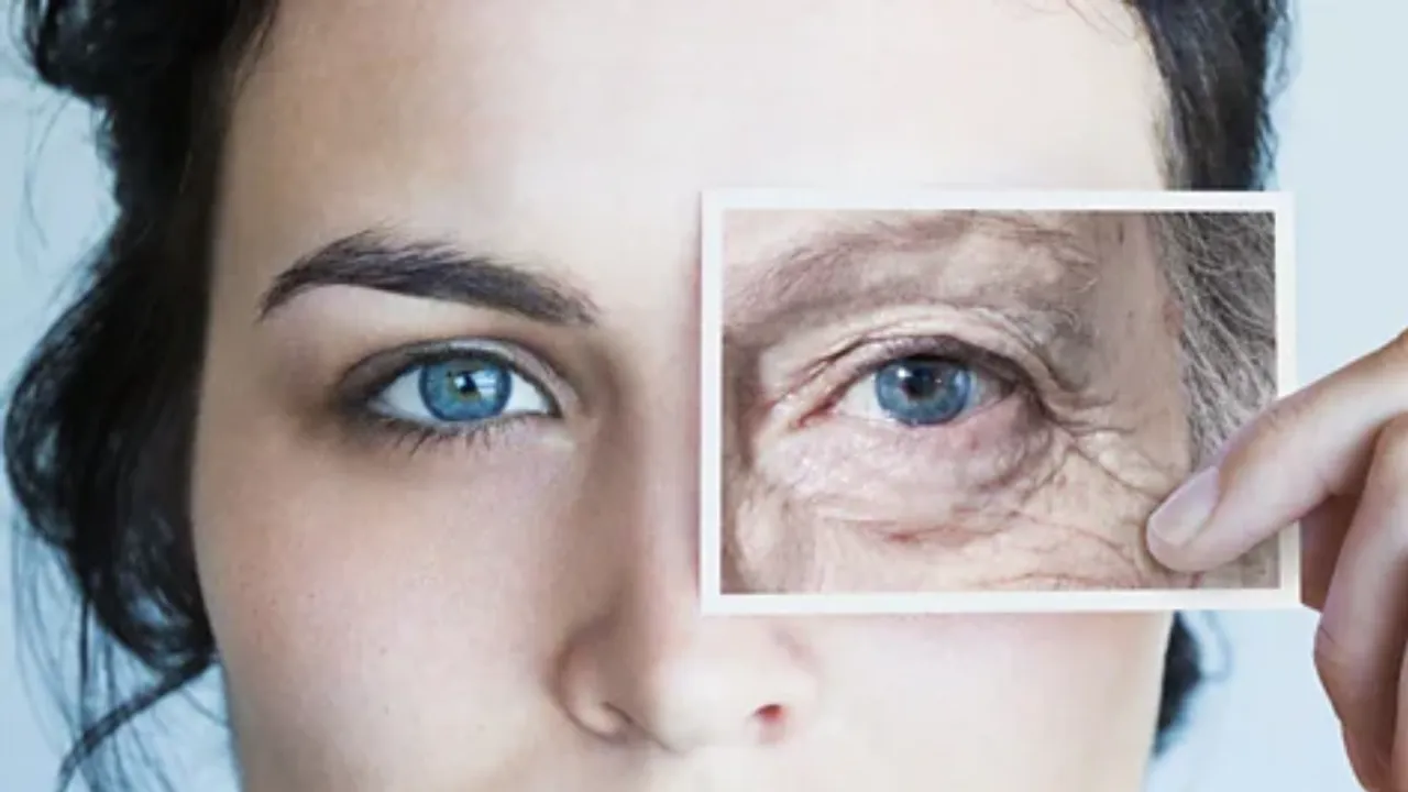 Aging 