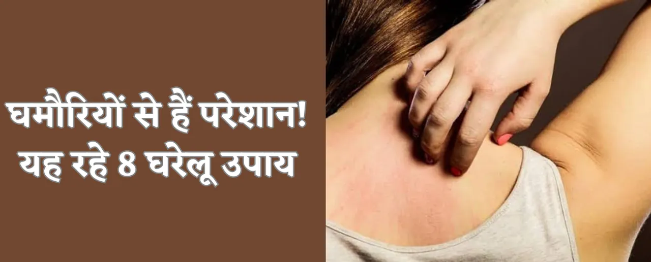 8 home remedies to get rid of heat rash