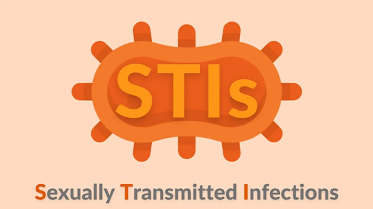 STI 