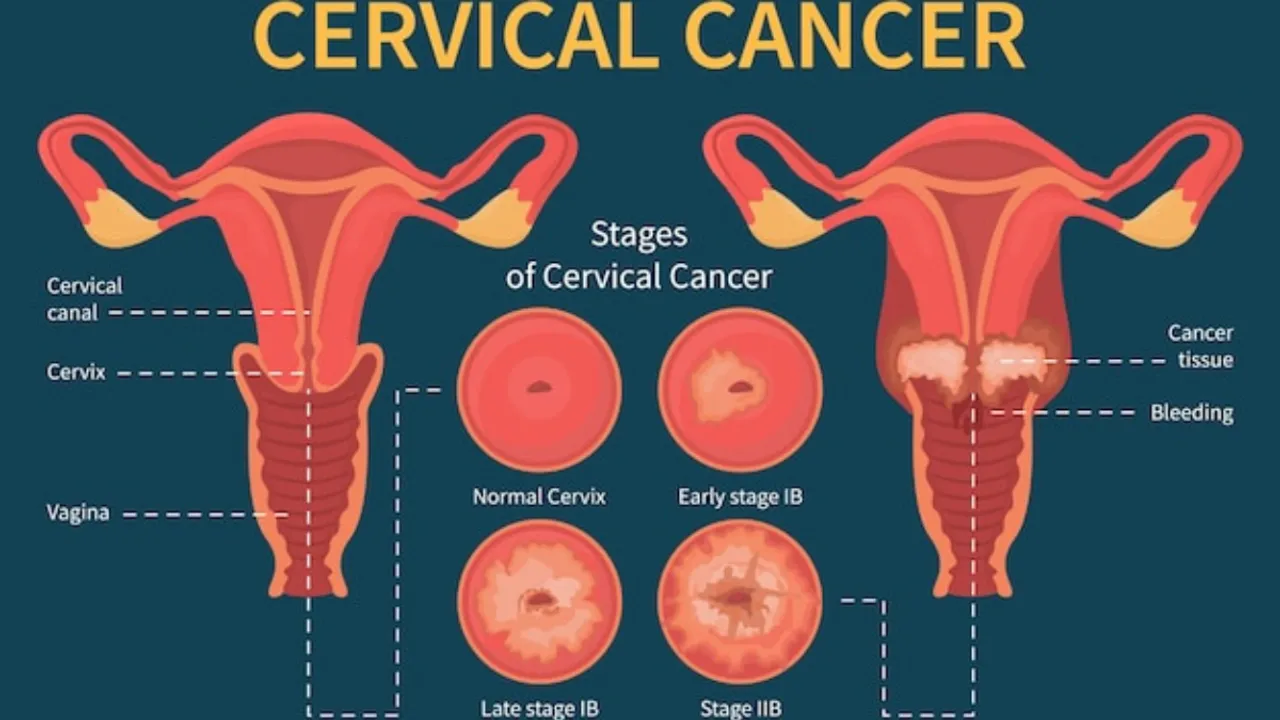 Cervical