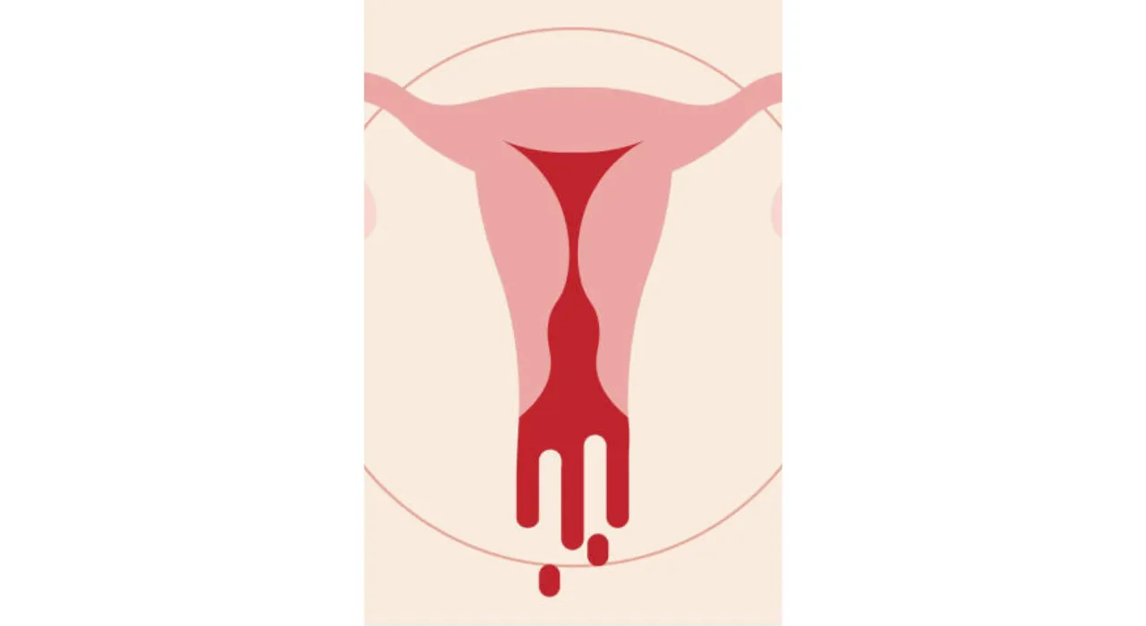 Heavy Period (Yahoo)