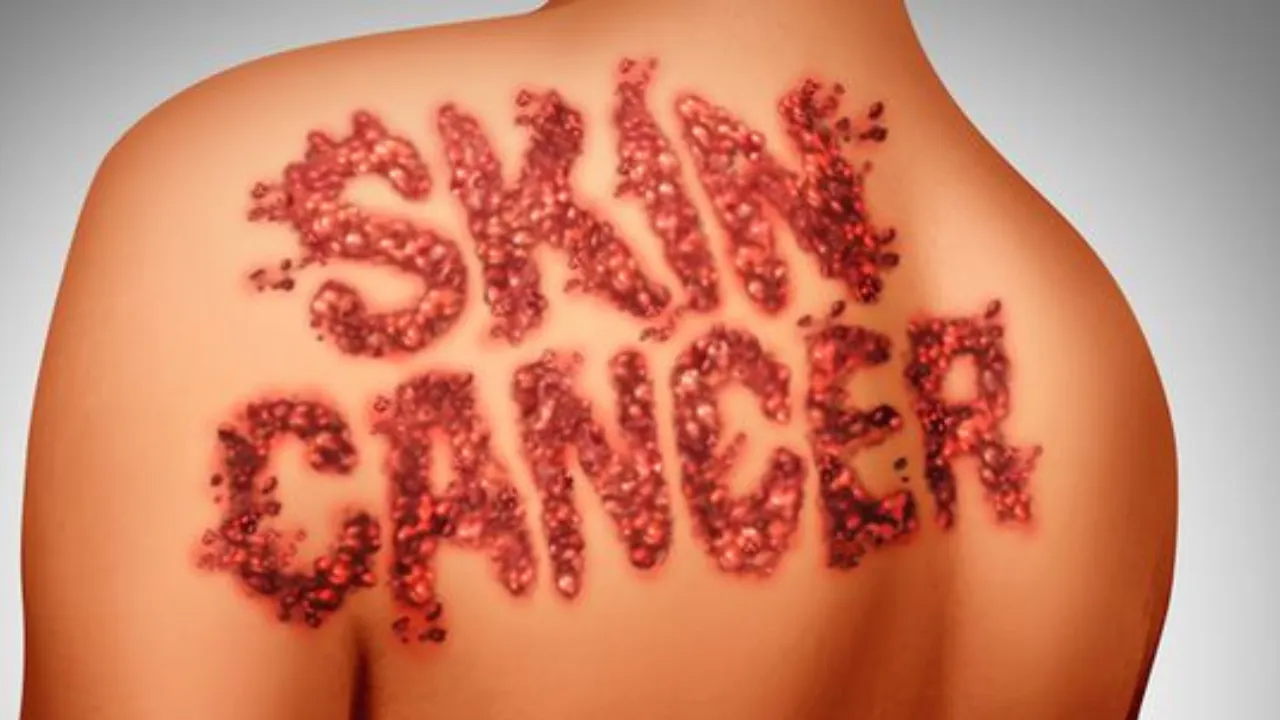 Cancer 
