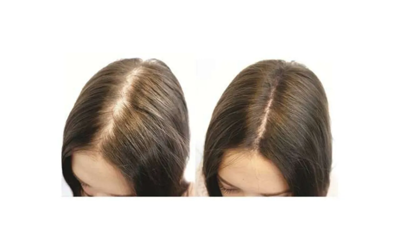  Try these 5 tips for fast Hair Growth 