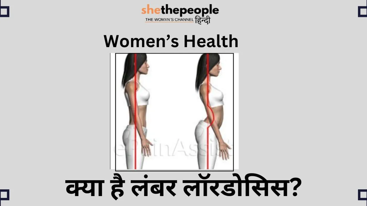lumber lordosis).jpg