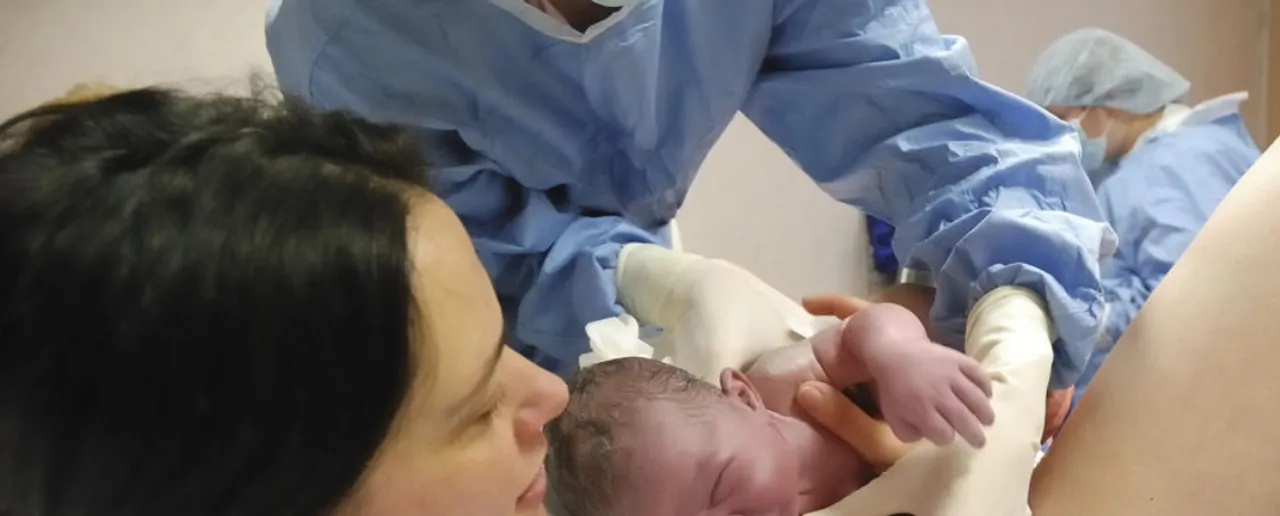 cesarean delivery