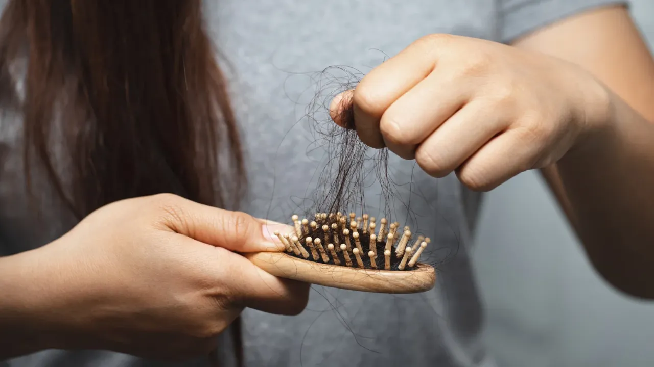 Hair Loss 