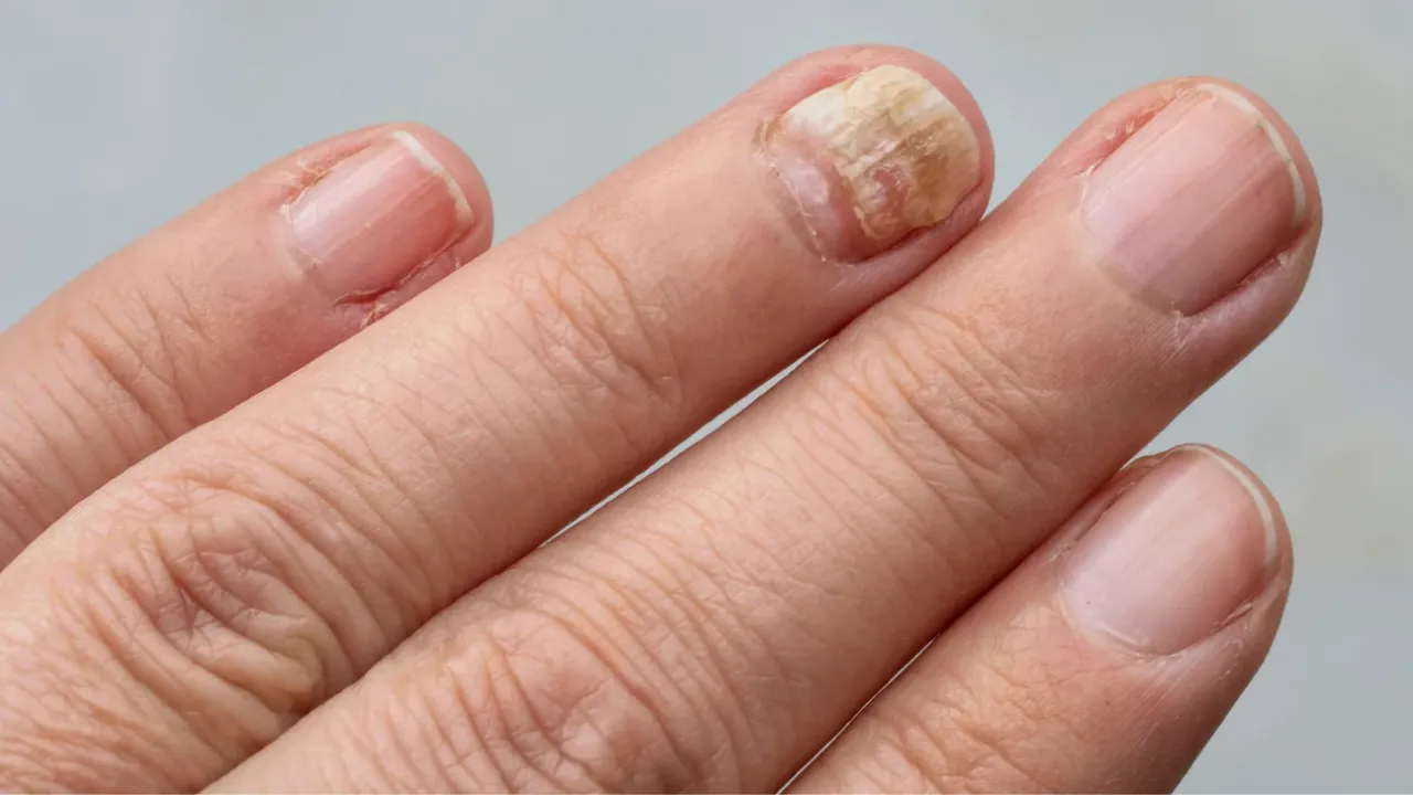 Nail colour vh