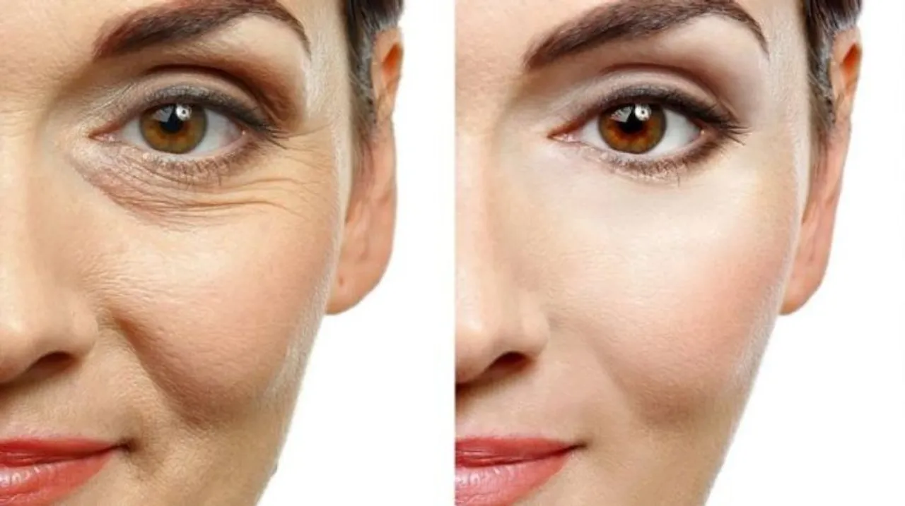 guide to botox treatment 