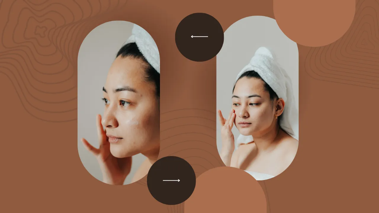 face pimples (Canva)