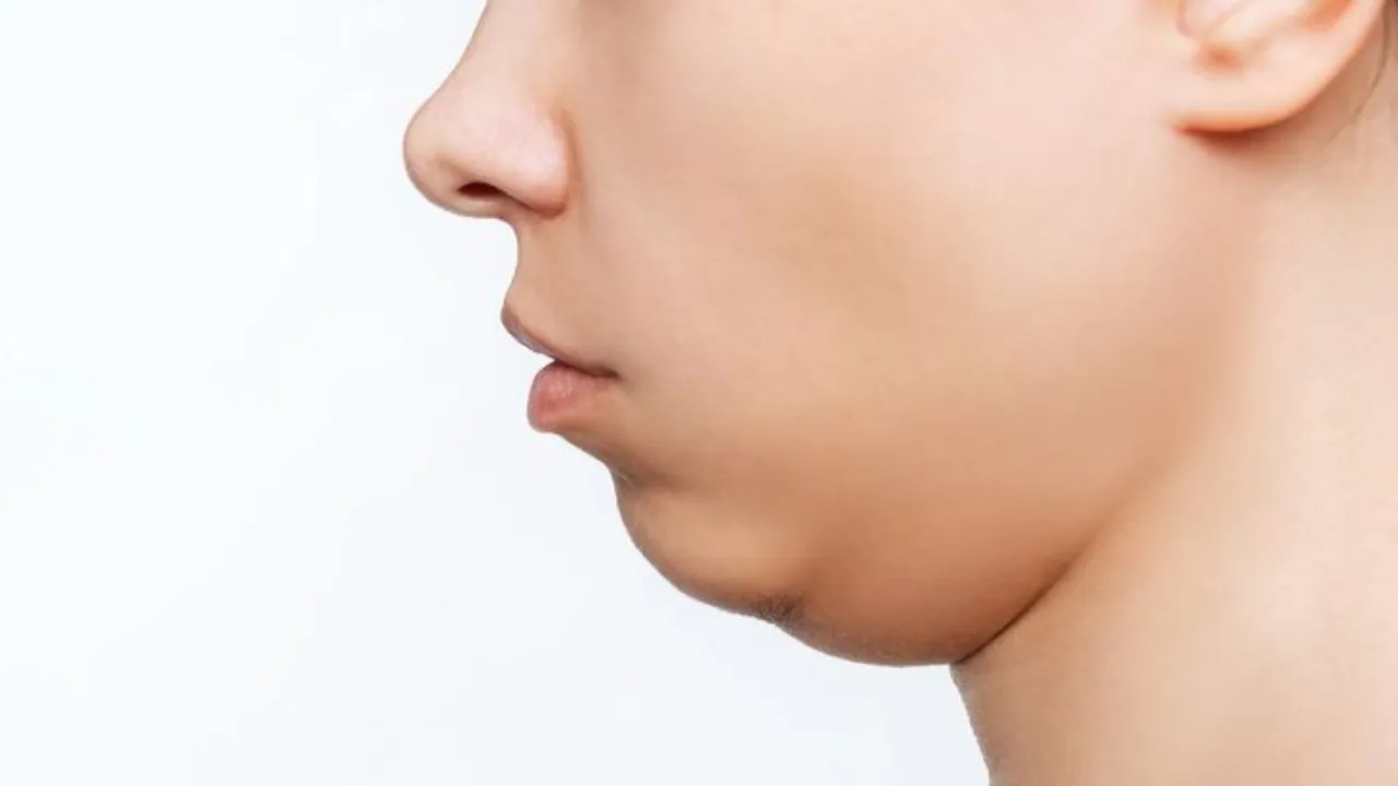 Exercise to reduce double chin