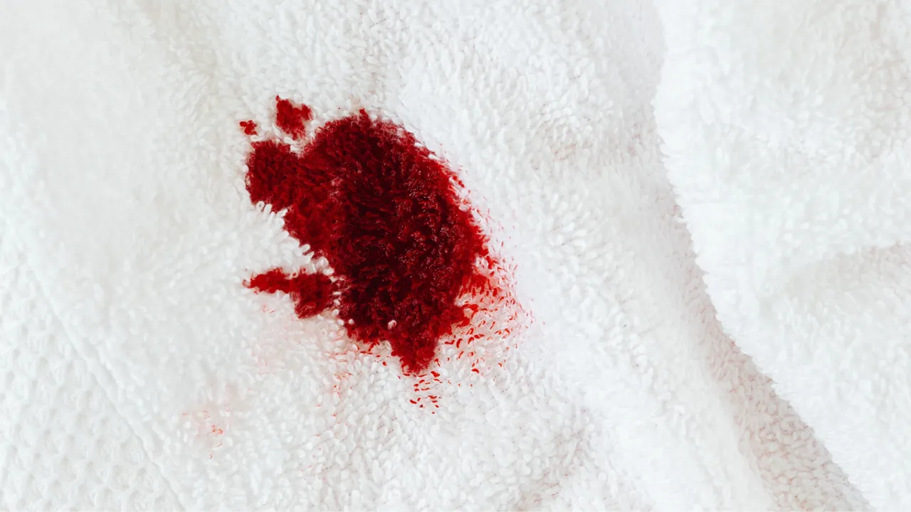 Bleeding After Sex