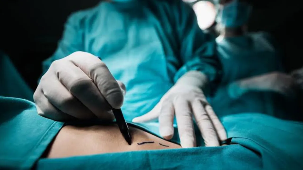 Forced Sex Change Surgery