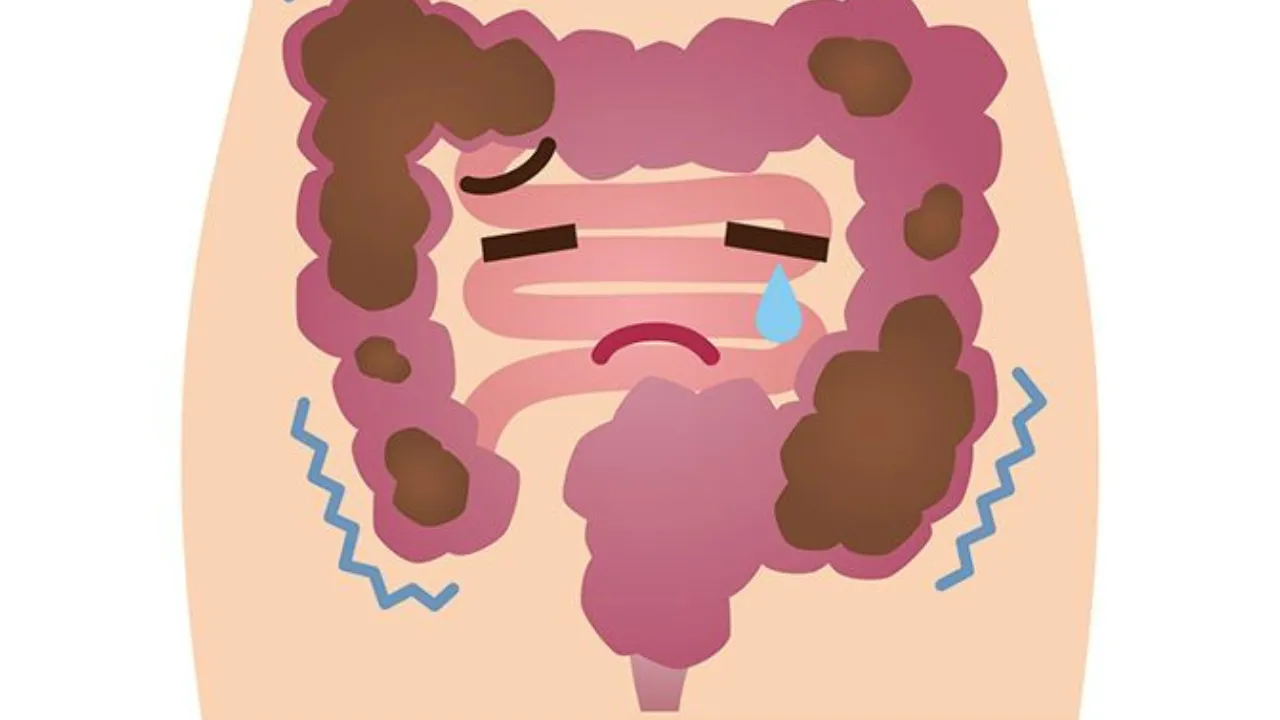 How To Treat Constipation