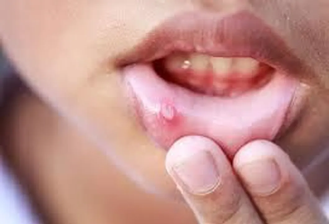 Tips For Blister: इन 4 टिप्स की मदद से आप पा सकती हैं छालों से छुटकारा