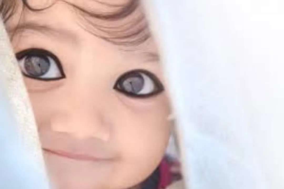 गर्मी में नवजात बच्चे की स्किन का ध्यान कैसे रखें ?