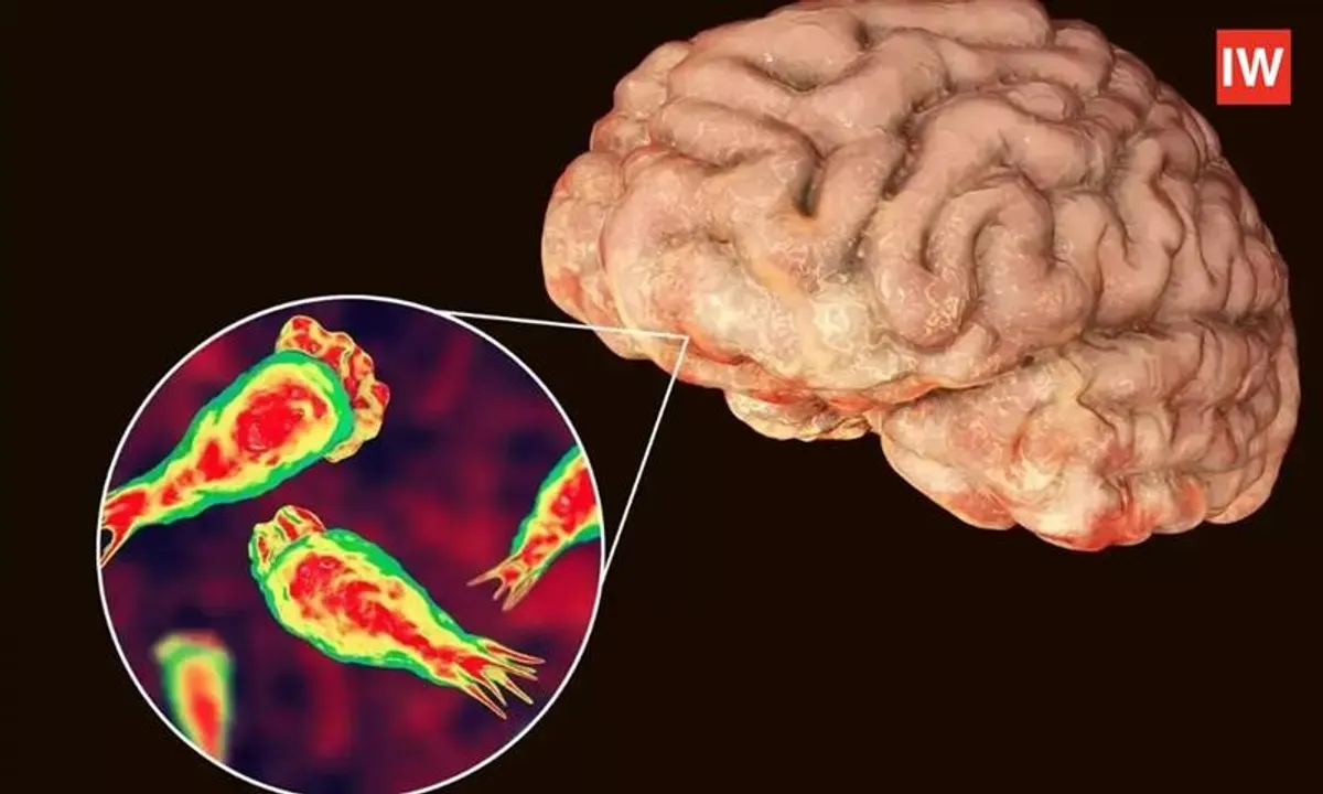  Kerala Under Threat: Deadly 'Brain-Eating Amoeba' Claims 19 Lives; Causes, Symptoms & Safety Tips