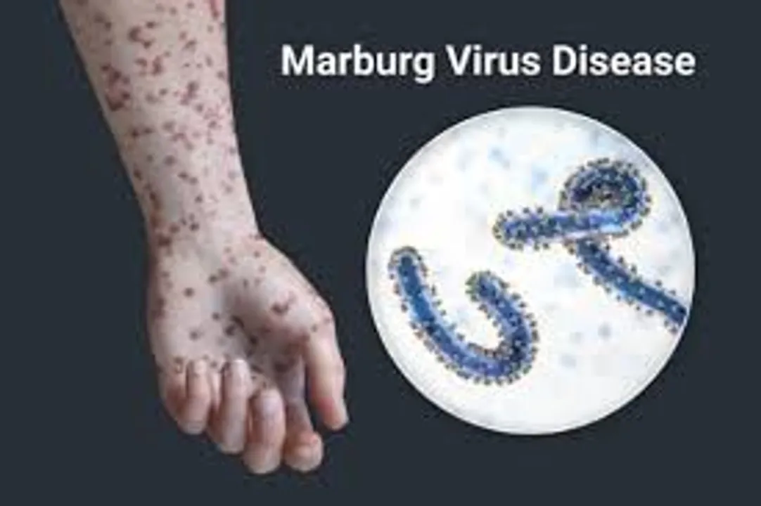marberg virus