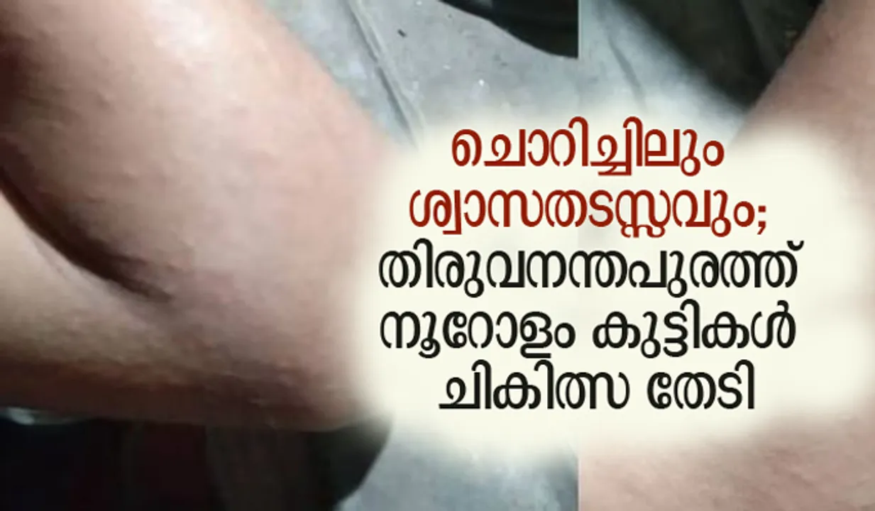 ചൊറിച്ചിലും ശ്വാസതടസ്സവും; തിരുവനന്തപുരത്ത് നൂറോളം കുട്ടികള്‍ ചികിത്സ തേടി