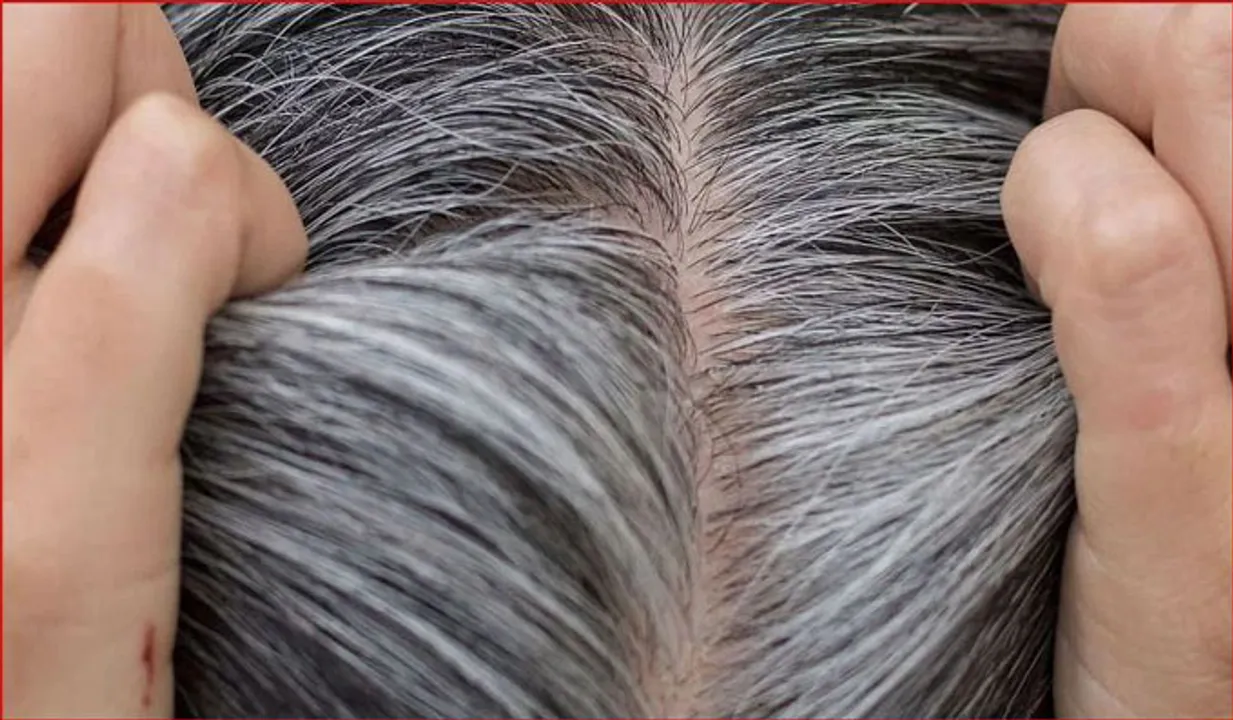 അകാലനര നിങ്ങളെ അലട്ടുന്നുണ്ടോ? പ്രതിവിധി ഇതാ
