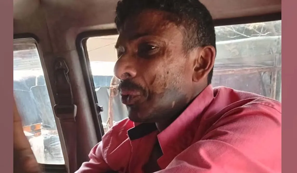 കണ്ണൂരില്‍ യുവാവിന്റെ മുഖത്ത് ആസിഡ് ഒഴിച്ച സംഭവം; പ്രതി പിടിയില്‍