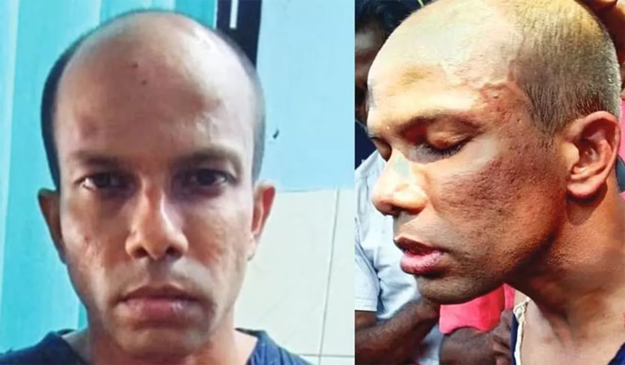 ചുണ്ടില്‍ ലിപ്സ്റ്റിക്, തലയില്‍ ഷാള്‍, ജീവനക്കാരിയുടെ തല തകര്‍ത്തു; മുമ്പും സ്ത്രീവേഷത്തില്‍ മോഷണശ്രമം