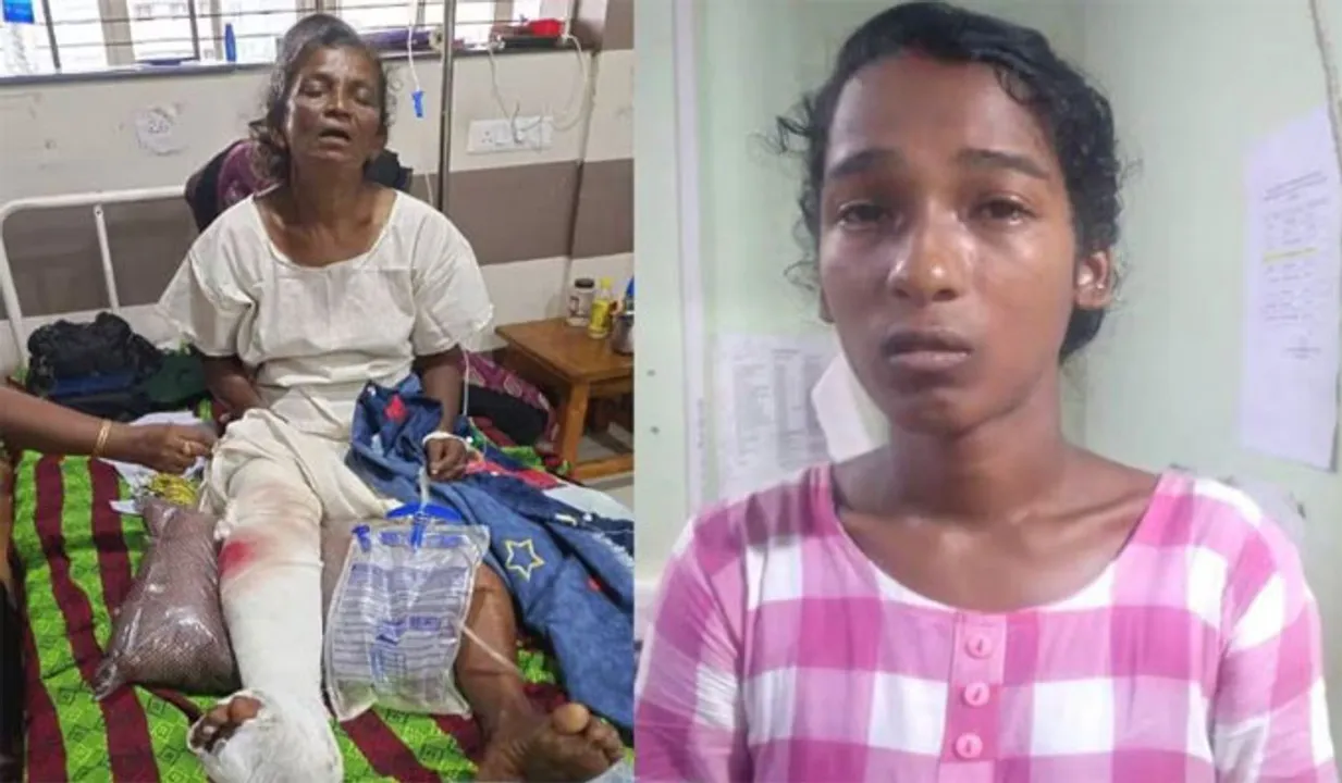  ആണ്‍വേഷം കെട്ടി വയോധികയുടെ കാല്‍ തല്ലിയൊടിച്ചു:മരുമകള്‍ പിടിയില്‍