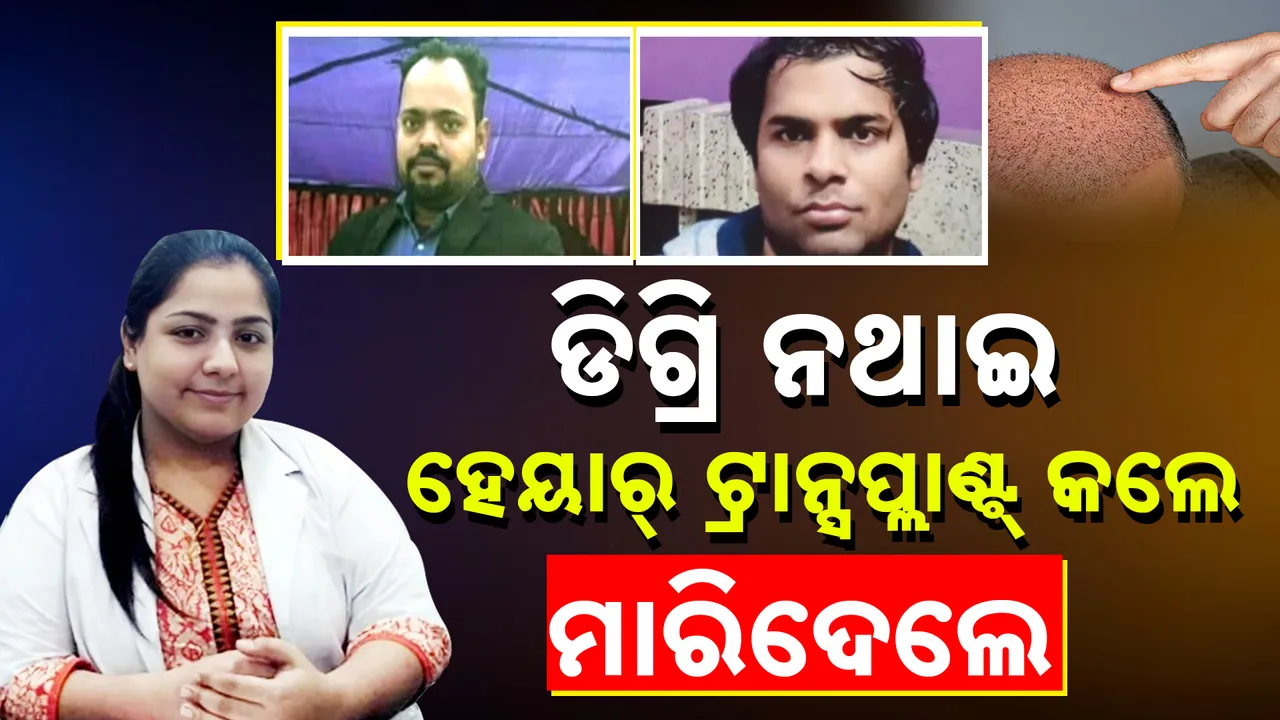  Hair Transplant Photograph: (Kanak News) 