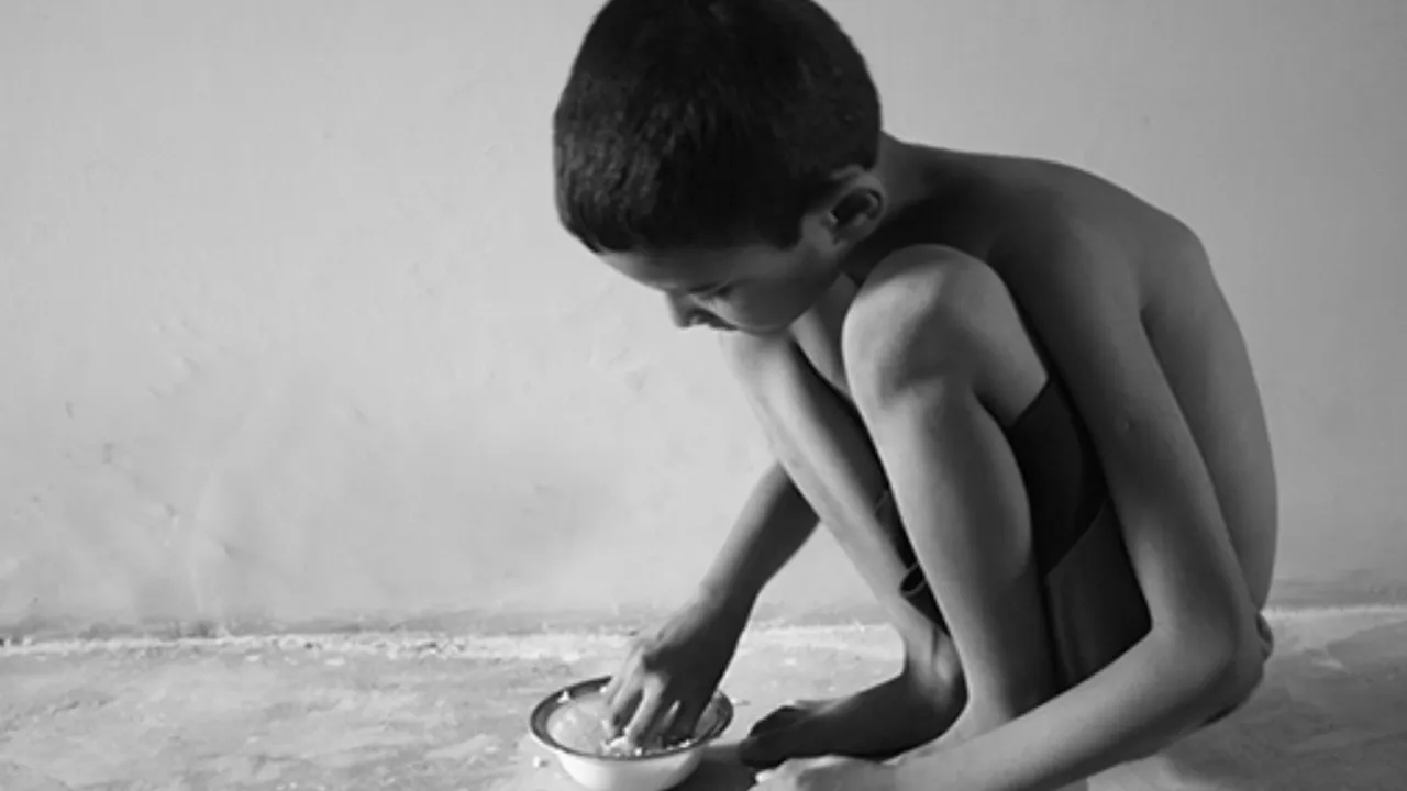  Malnutrition Photograph: (KANAK NEWS) 