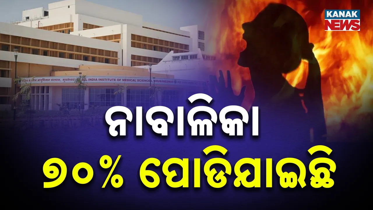  ବଳଙ୍ଗା ପୀଡ଼ିତାଙ୍କ ଶରୀରର ୭୦ ପ୍ରତିଶତ ପୋଡ଼ିଯାଇଛି ; ଏମ୍ସ ବର୍ଣ୍ଣ ୟୁନିଟକୁ ସ୍ଥାନାନ୍ତର କରାଯାଇଥିବା ସୂଚନା