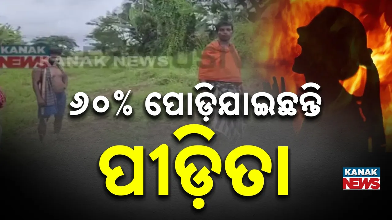  ନାବାଳିକା  ୬୦% ପୋଡି ଯାଇଛନ୍ତି Photograph: (KanakNews) 