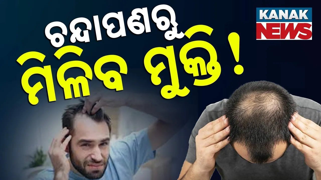  ଚନ୍ଦାପଣ ଭୋଗୁଥିବା ବ୍ୟକ୍ତିଙ୍କ ପାଇଁ ଖୁସିଖବର, ଏହି ଉପାୟ କଲେ ଗହଳ ହେବ କେଶ !