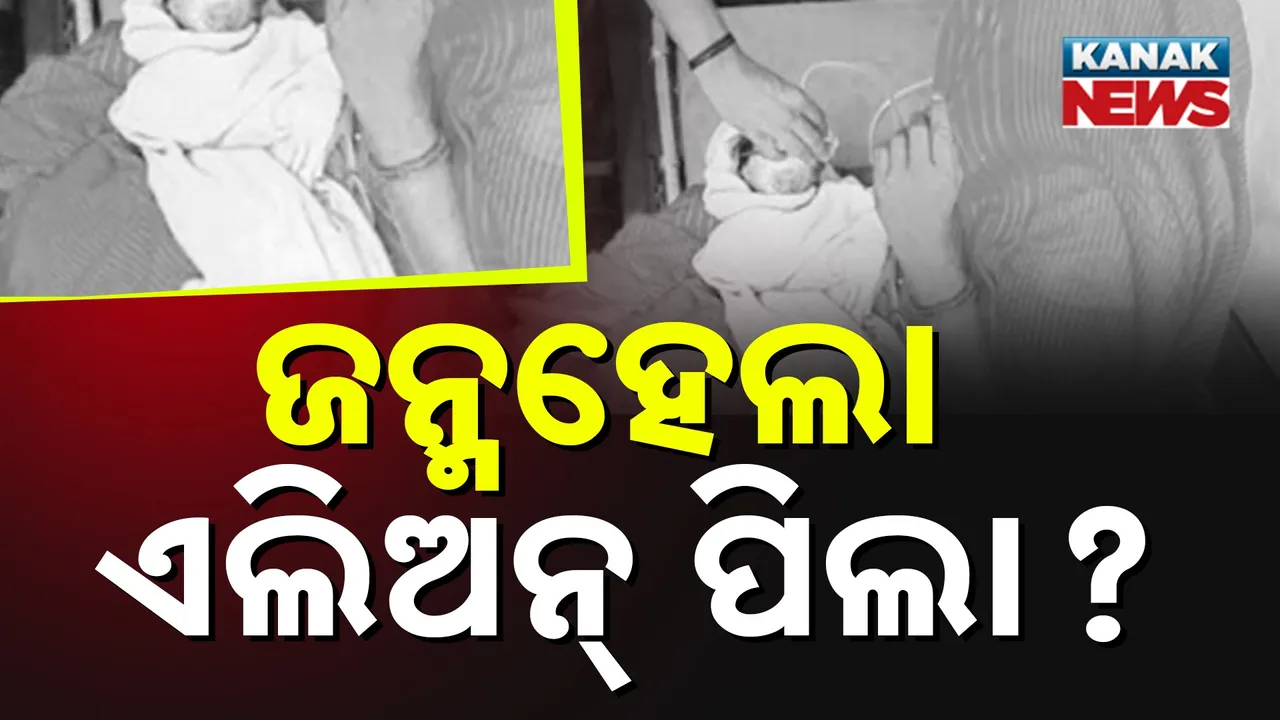  child-born Photograph: (Kanak News) 
