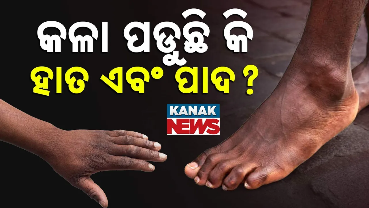  HandFeet Photograph: (KanakNews) 