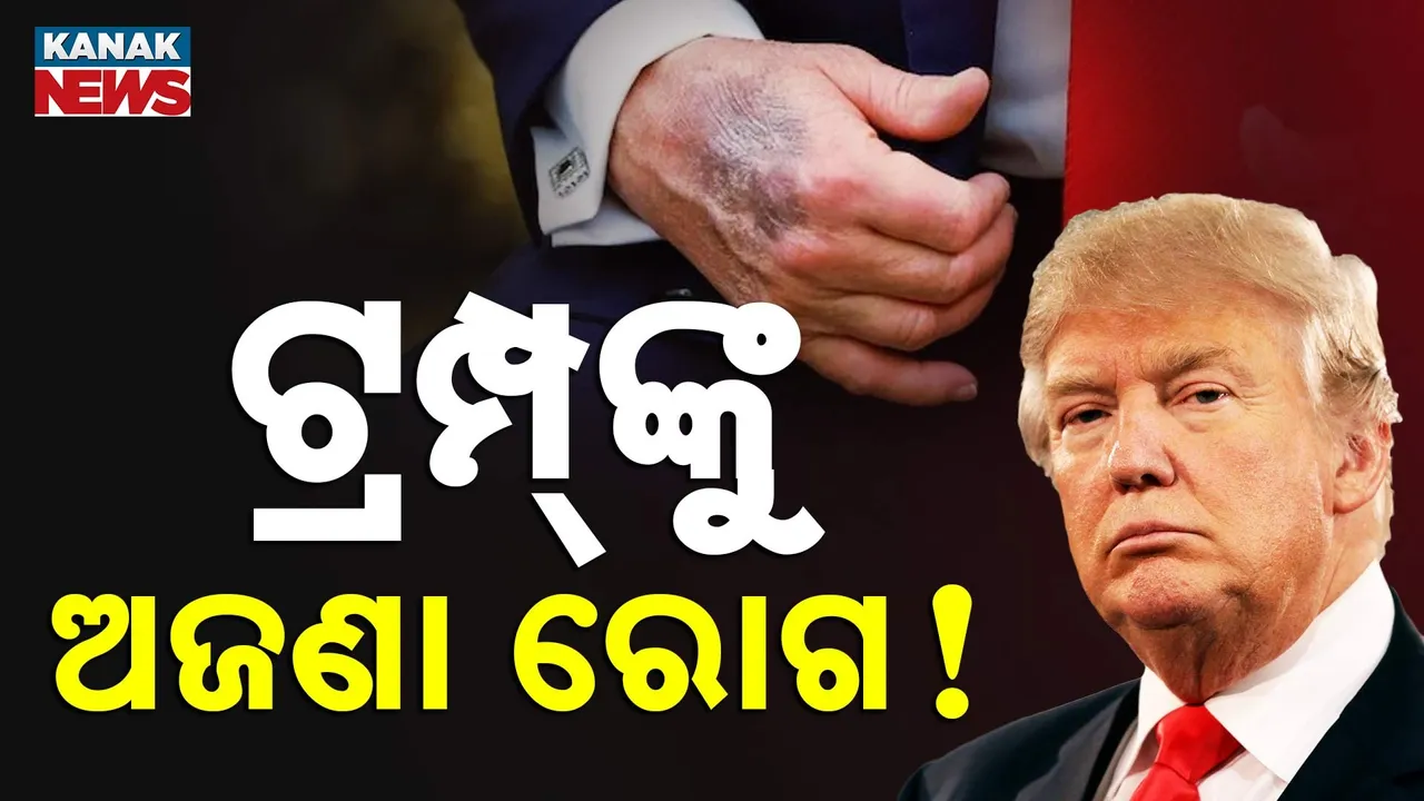  ଡୋନାଲ୍ଡ ଟ୍ରମ୍ପଙ୍କ ସ୍ୱାସ୍ଥ୍ୟ ଠିକ୍ ନାହିଁ କି? Photograph: (KanakNews) 
