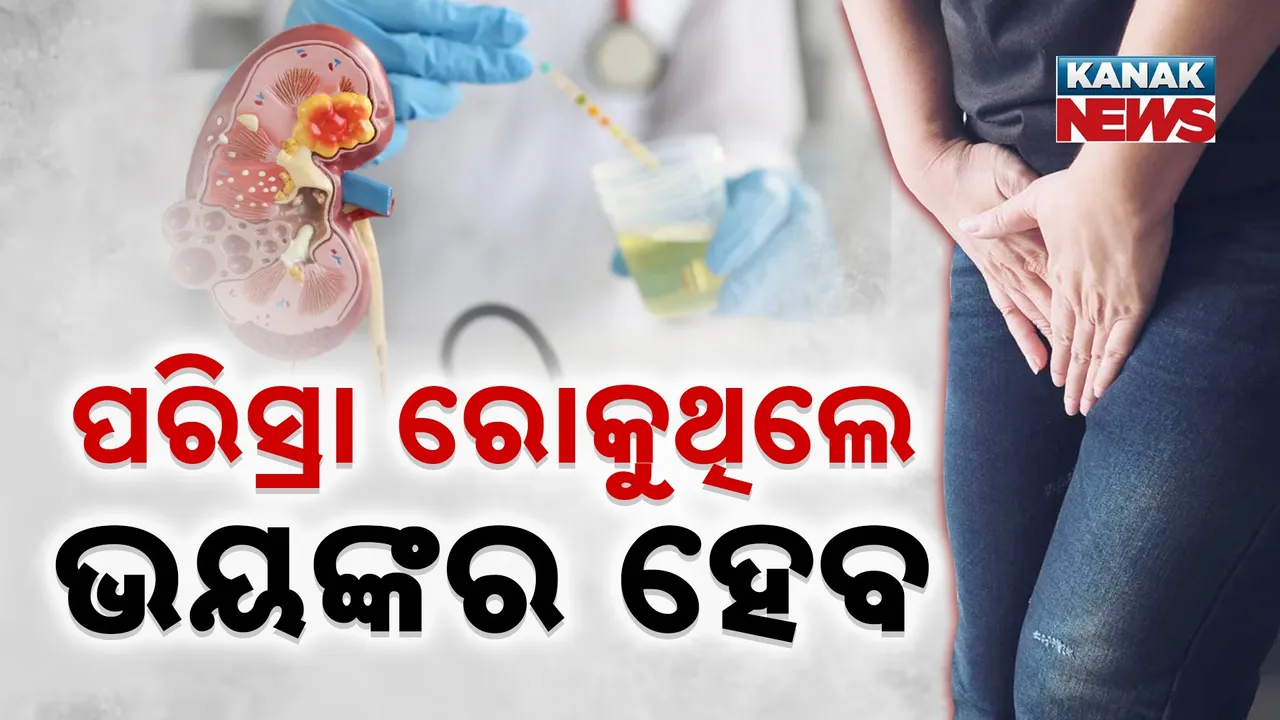  Urine Photograph: (KanakNews) 