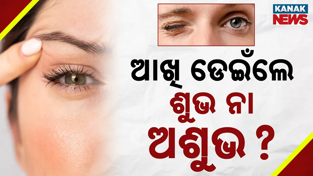  eye Photograph: (kanakNews) 