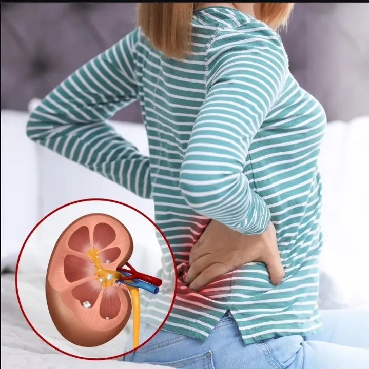  Photograph: (KANAKNEWS) 