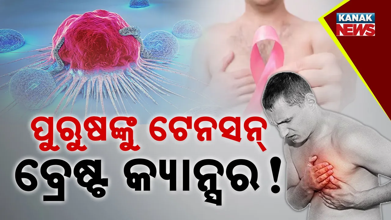  Male breast cancer Photograph: (Kanak News) 