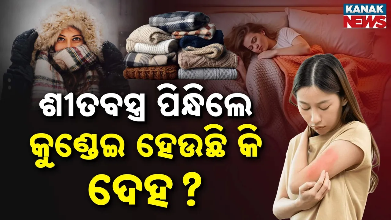  Wool Fabric Allergy Photograph: (Kanak News) 