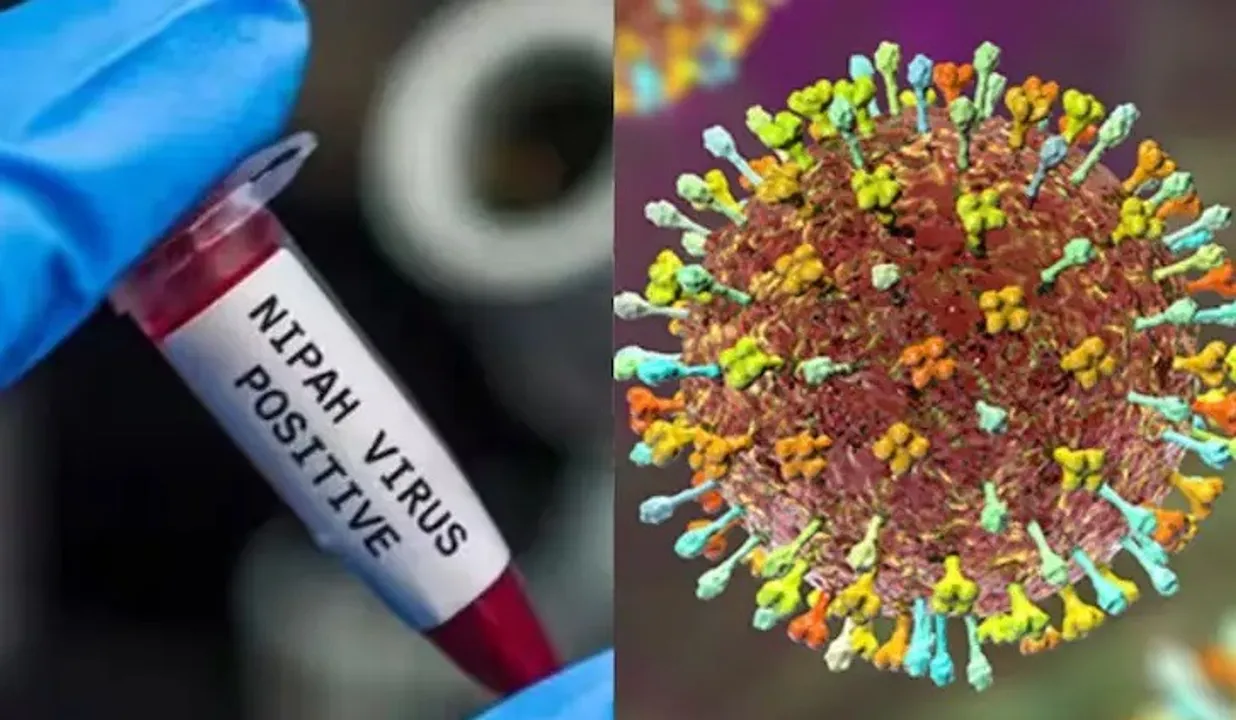  Photograph: (kanaknews) 