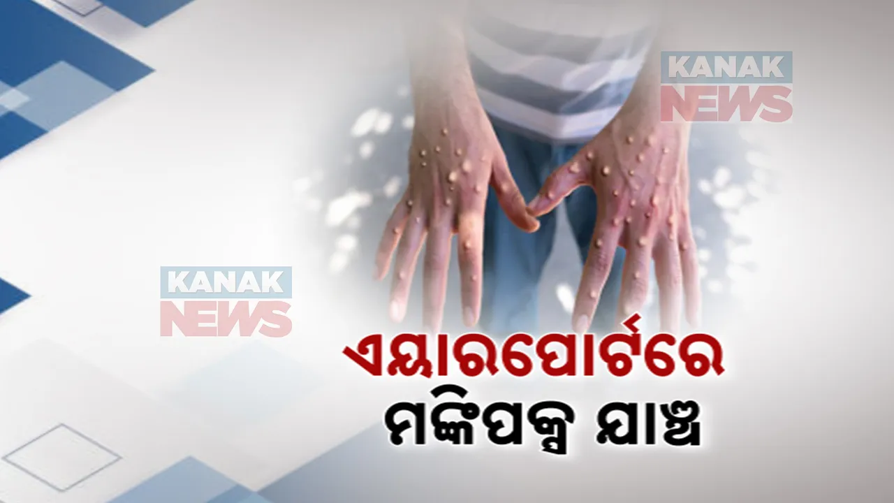  ମଙ୍କିପକ୍ସ ରୋକିବାକୁ ତତ୍ପର ଭାରତ ସରକାର ; ସବୁ ବିମାନବନ୍ଦରରେ ଯାତ୍ରୀଙ୍କୁ କଡ଼ାକଡ଼ି  ଯାଞ୍ଚ