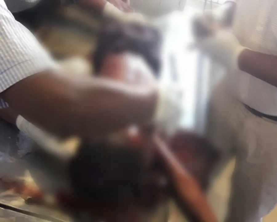  ରାଉରକେଲା : ଲହୁଣୀପଡାର ସୋଏମ୍ବାରେ ସ୍କୁଲ ଅଟୋକୁ ଧକ୍କା ଦେଲା ଡମ୍ପର, ୩ ଜଣ ଛାତ୍ରଛାତ୍ରୀଙ୍କ ସମେତ ଡ୍ରାଇଭର ମୃତ