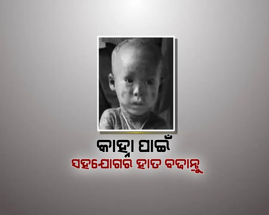  ଅସାଧ୍ୟ ଚର୍ମରୋଗରେ ପୀଡ଼ିତ ୩ ବର୍ଷର କାହ୍ନା ! ସାହାଯ୍ୟ ଲୋଡ଼ୁଛନ୍ତି ପରିବାର, ଆପଣଙ୍କ ସହଯୋଗ ବଦଳାଇ ଦେବ ଏକ ନିରୀହ ଶିଶୁର ଜୀବନ