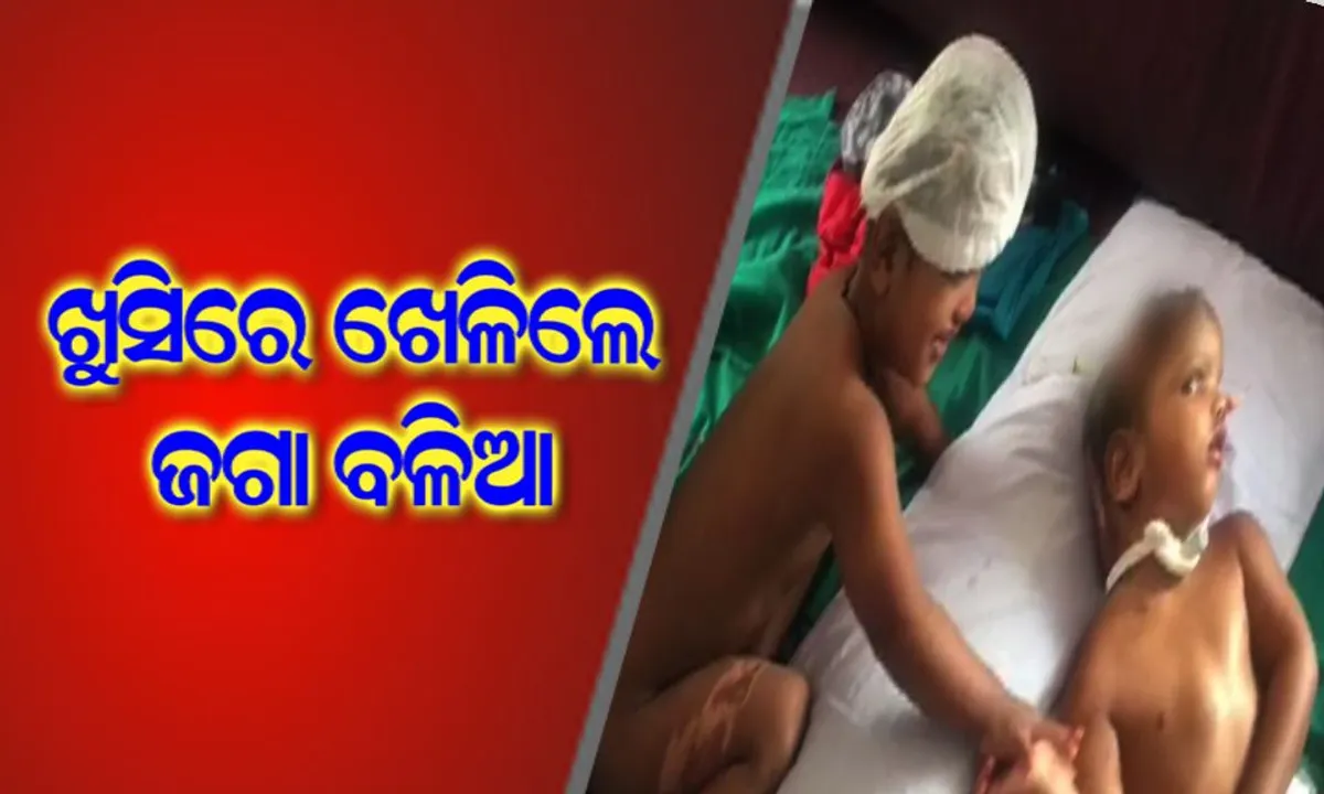  ବିରଳ ଅସ୍ତ୍ରୋପଚାର ପରେ ପ୍ରଥମ ଥର ପାଇଁ ଖୋଲା ଦେହରେ ସାମ୍ନାକୁ ଆସିଲେ ଜଗା-ବଳିଆ ! ହସଖୁସିରେ ଖେଳିଲେ ଦୁଇ ଭାଇ, ଏମ୍ସ ଜାରି କଲା ଭିଡ଼ିଓ