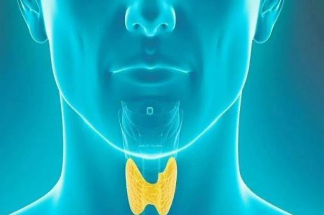  source : Thyroid 