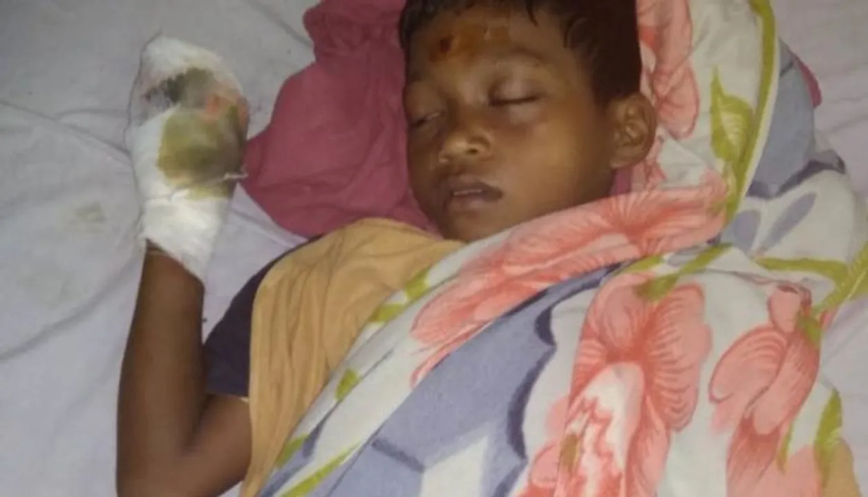 ଖେଳୁଥିବା ବେଳେ ଫାଟିଲା ପୁରୁଣା ମୋବାଇଲ ବ୍ୟାଟେରୀ ! ୮ ବର୍ଷର ଶିଶୁ ହରାଇଲା ଚାରୋଟି ଆଙ୍ଗୁଠି ।