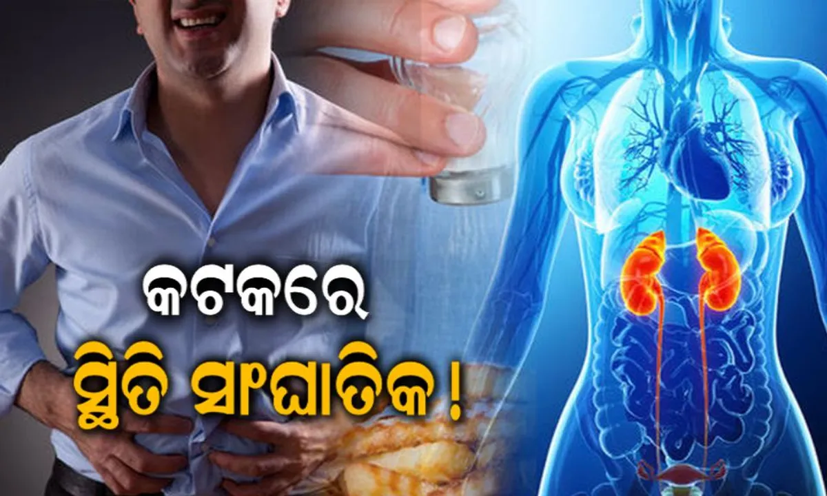  ଆପଣ ଜାଣିଛନ୍ତି କି, ରାଜ୍ୟରେ କିଡ଼ନୀ ରୋଗୀଙ୍କ ସଂଖ୍ୟା କେତେ ? ତଥ୍ୟ ଜାଣିଲେ ବଢିଯିବ ଚିନ୍ତା