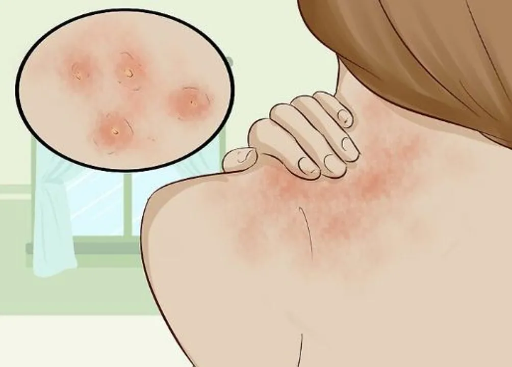  source : wikiHow 